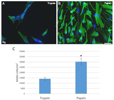 Optimization of a Method to Isolate and Culture Adult Porcine, Rats and Mice Müller Glia in Order to Study Retinal Diseases